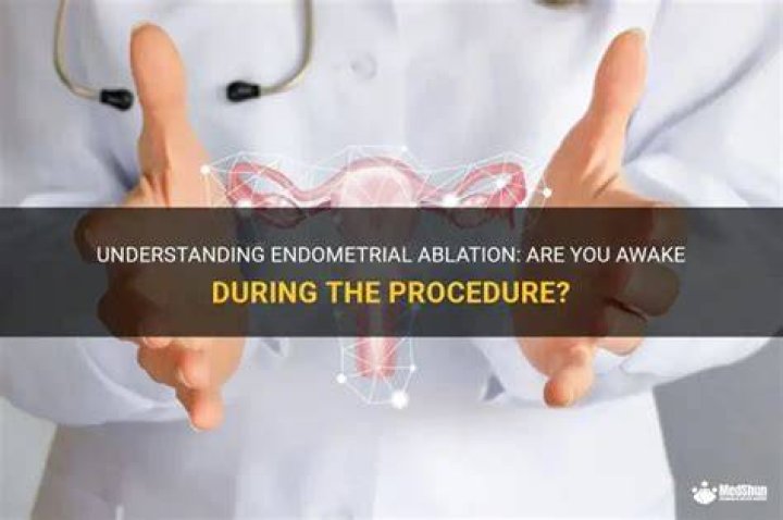 Are you awake for uterine ablation?