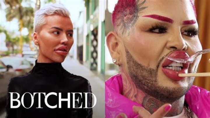 Botched Patient Can Literally Flip Her Butt Implants?Watch the Insane
