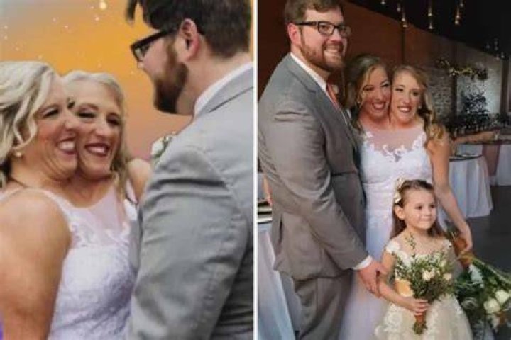 Brittany Conjoined Twins Married