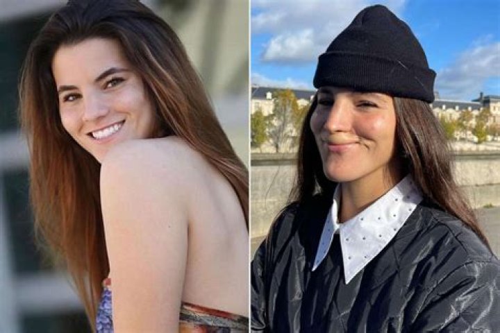 Brooklinn Khoury Shares BeforeandAfter Photos of Her Smile After Dog