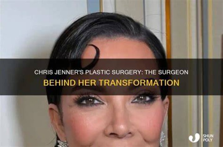 Chris Evert&rsquo;s Plastic Surgery Her New Look Examined!