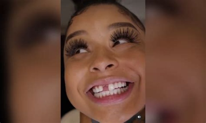 Chrisean Rock Flashes New Teeth After Fixing Missing Tooth HipHopDX