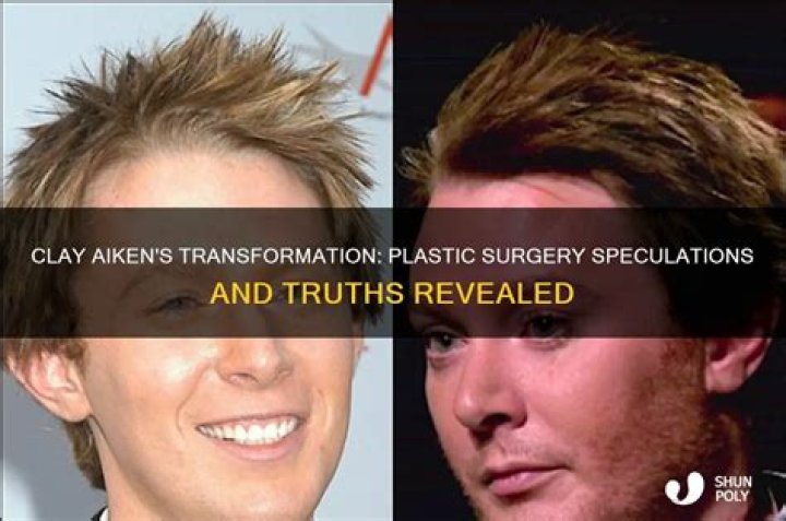 Did Clay Aiken Have Plastic Surgery? Everything You Need To Know