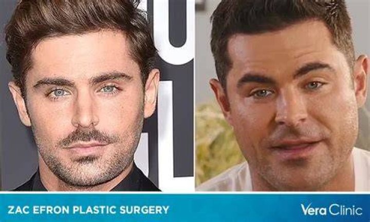 Did Zac Efron Get Plastic Surgery? Everything We Know Life & Style