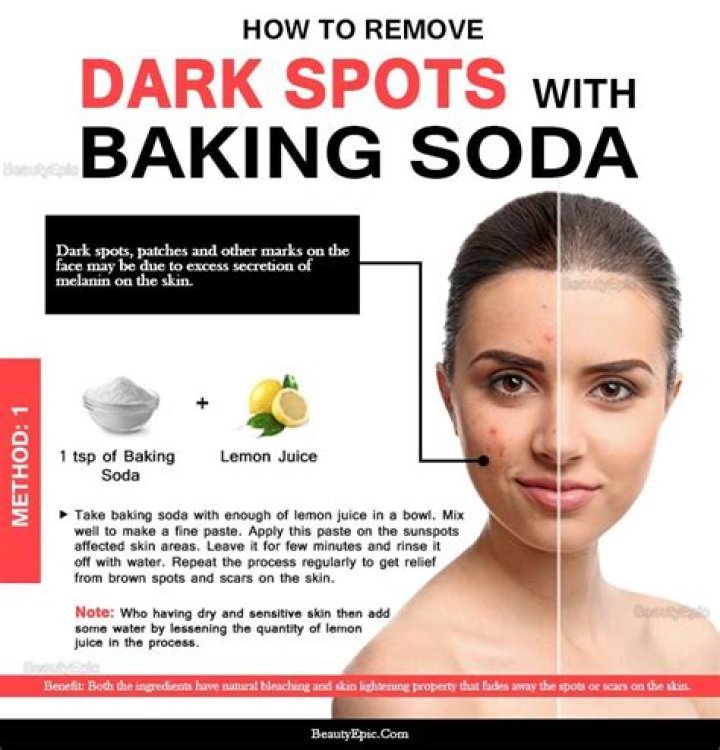 Does baking soda remove dark neck?