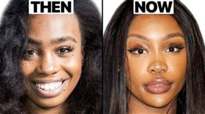 Fans Believe Sza Had Plastic Surgery, Reveal Photos Of Sza Before