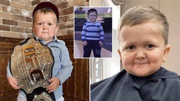 Hasbulla Magomedov Age, Condition, Net Worth Man of Many