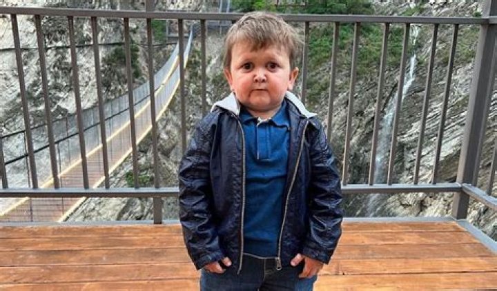 Hasbulla (Mini Khabib) Age, Height, Disease, Father, Net Worth