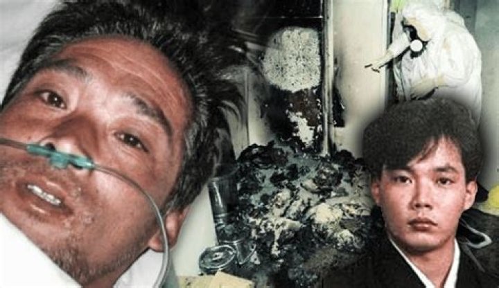 Hisashi Ouchi Real Photos Hospital Unveiling a Tragic Medical Case