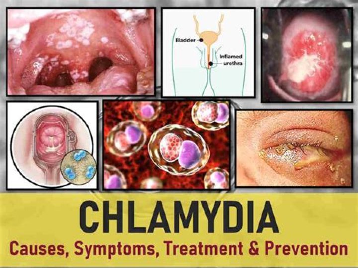 How did sheep get chlamydia?