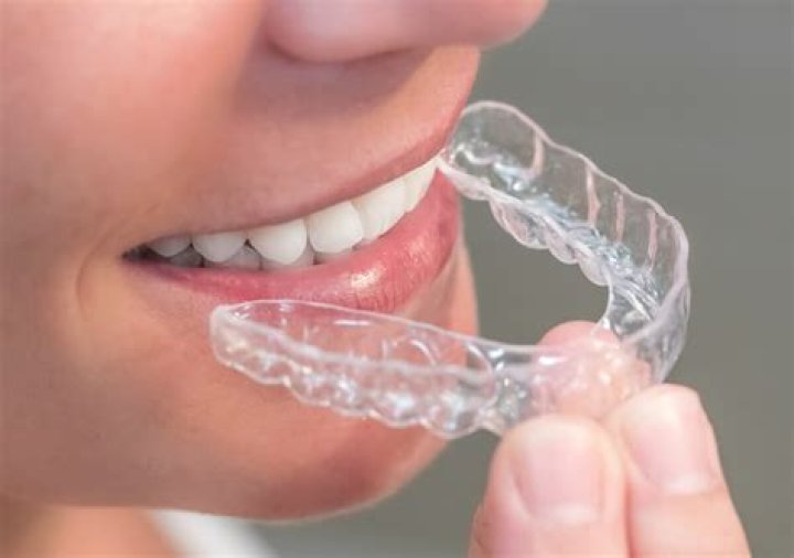 How much is a clear retainer?