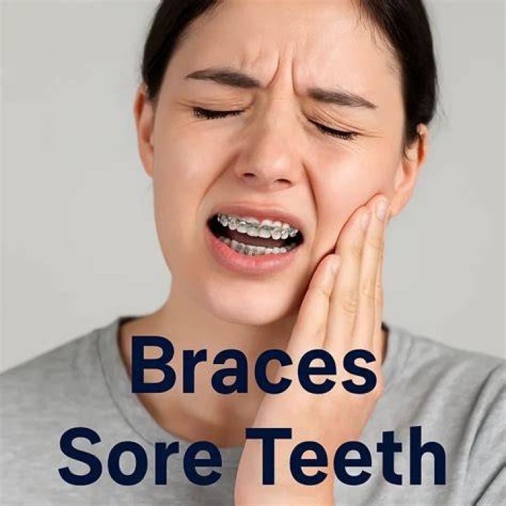How sore are kids after getting braces?