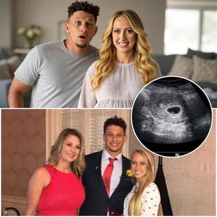 Is Brittany Mahomes Expecting: Uncovering The Truth