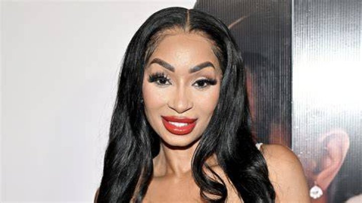 Karlie Redd Reveals 'Lip Injections' After Fan Says She Ruined Her Face