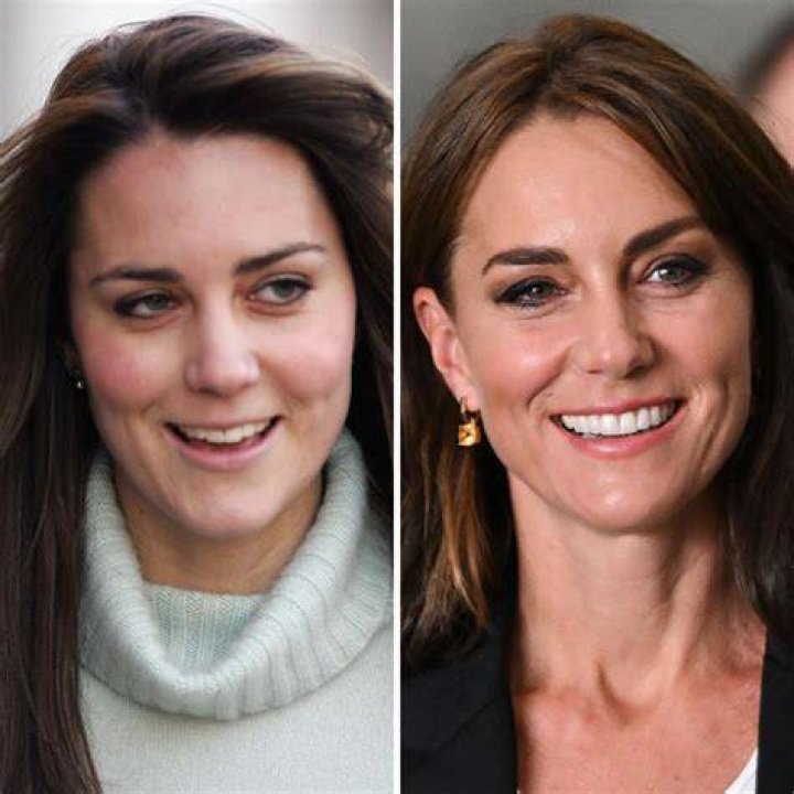 Kate Middleton Has Surgery Newsweek