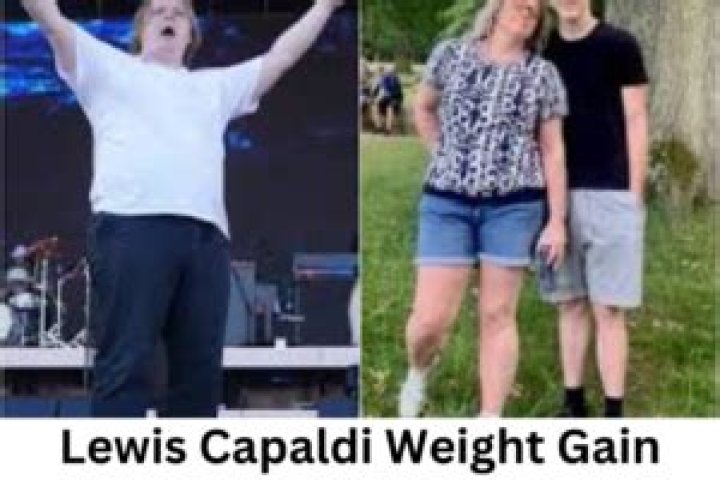 Lewis Capaldi’s Weight Gain in 2023 The Singer Looks Way Too Heavier!