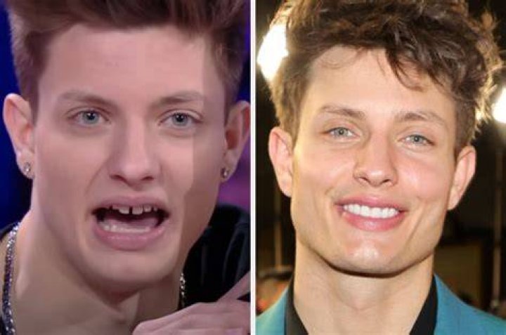 Matt Rife responds to plastic surgeon’s claim he gave ‘greatest jawline