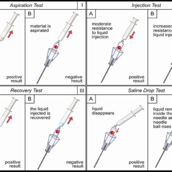 Needle positioning tests Aspiration test aspiration using a 5 ml
