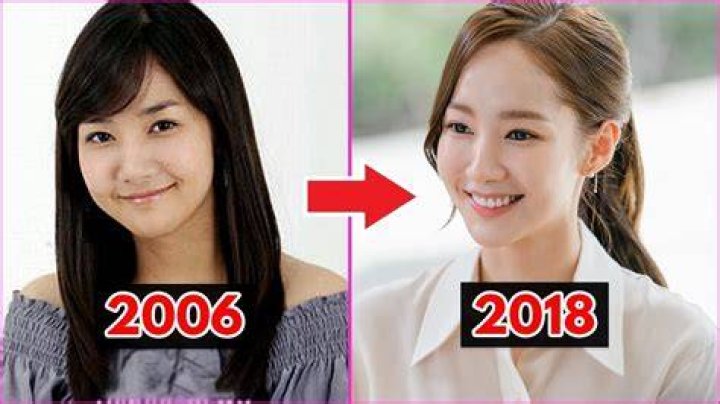 Park Min Young Before And After