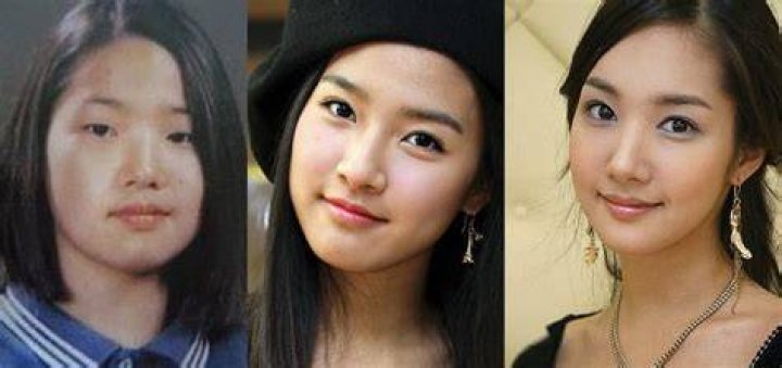 Park min young plastic surgery before and after pictures About Korean