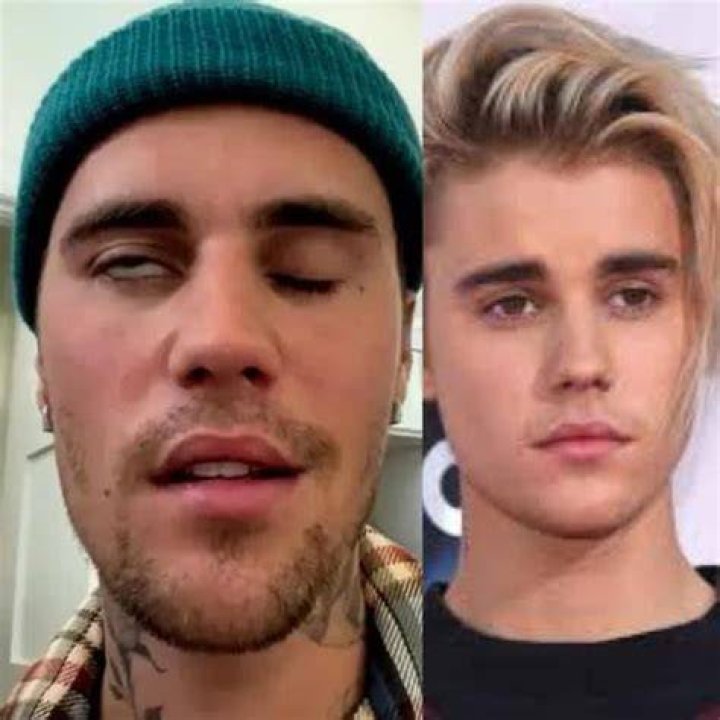 See footage from Justin Bieber’s first show after recovering from