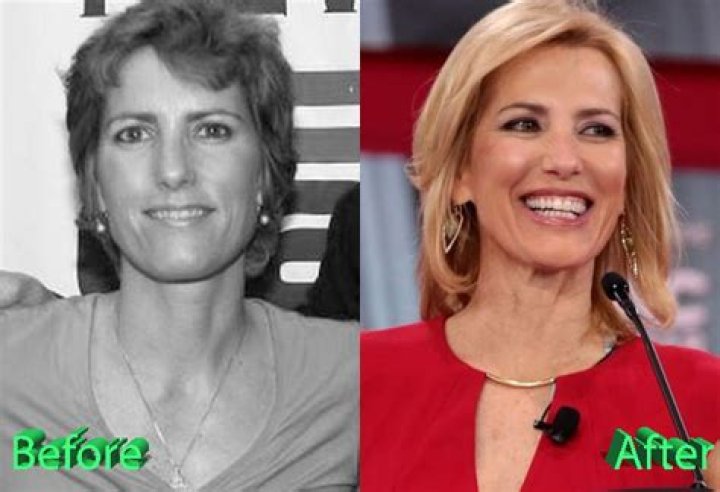 Unveiling The Truth: Exploring Laura Ingraham's Plastic Surgery Journey