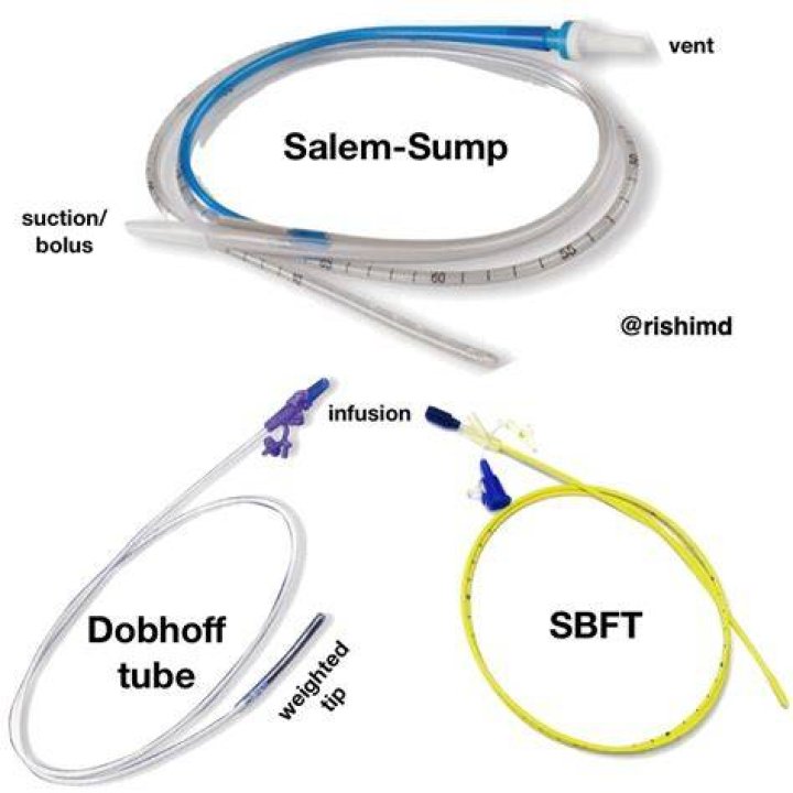 What is a Dobhoff Tube? (with pictures)