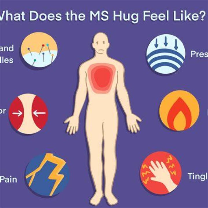 What is MS hug?
