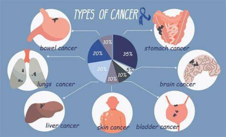 What type of cancer did OJ Simpson have? Here's what we know