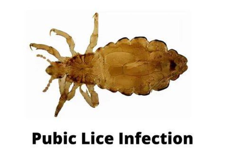 What type of STD is pubic lice?