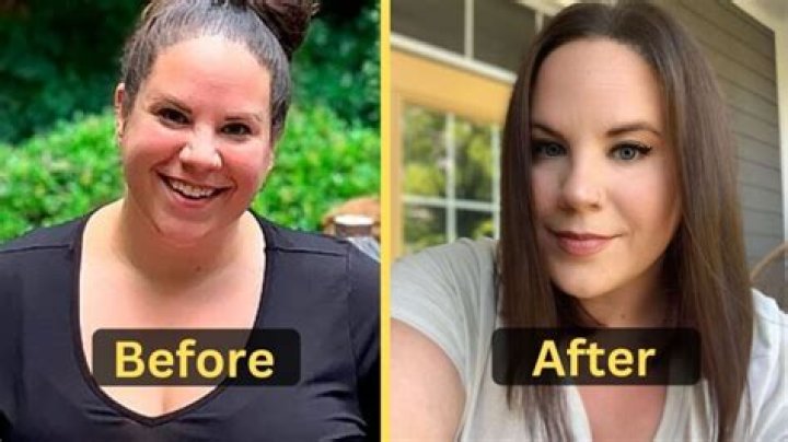 Whitney Thore Weight Loss Surgery, Diet & Workout Weight Loss