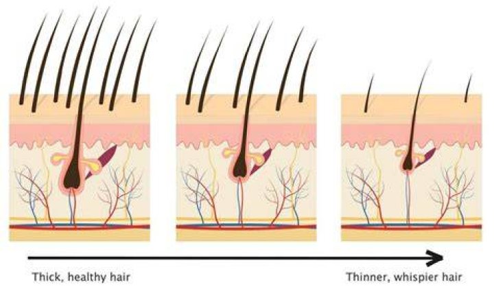 Why is my hair getting lighter and thinner?