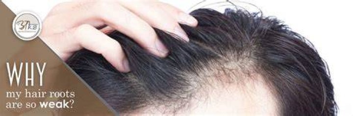 Why my hair roots are weak?