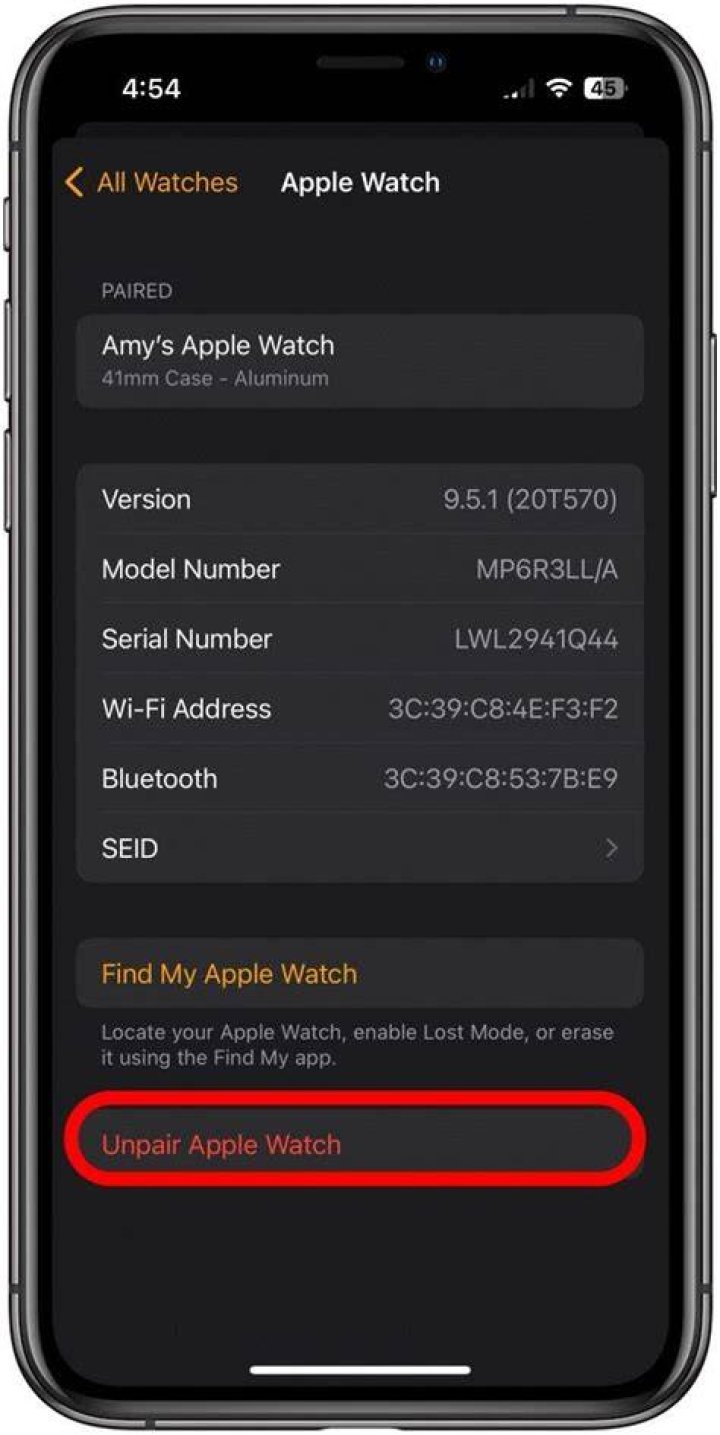 Why won't my Apple Watch let me slide up?